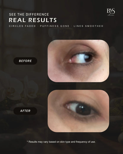 Under Eye Cream