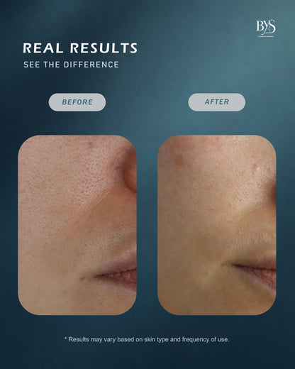 Facial Toner