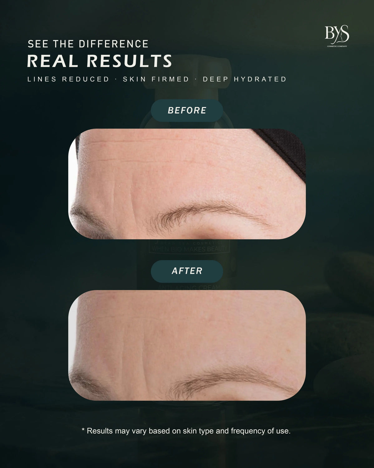 Anti-aging Cream