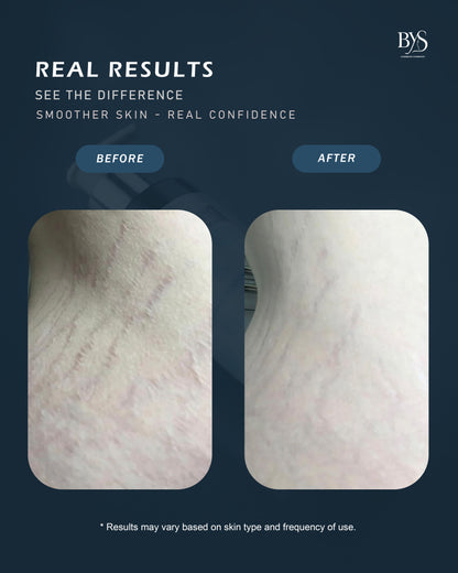 Dead Sea Anti-Stretch Mark Cream