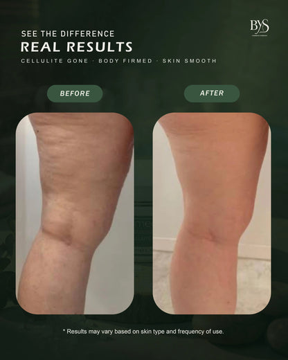 Dead Sea Anti-Cellulite and Lifting Body Mud